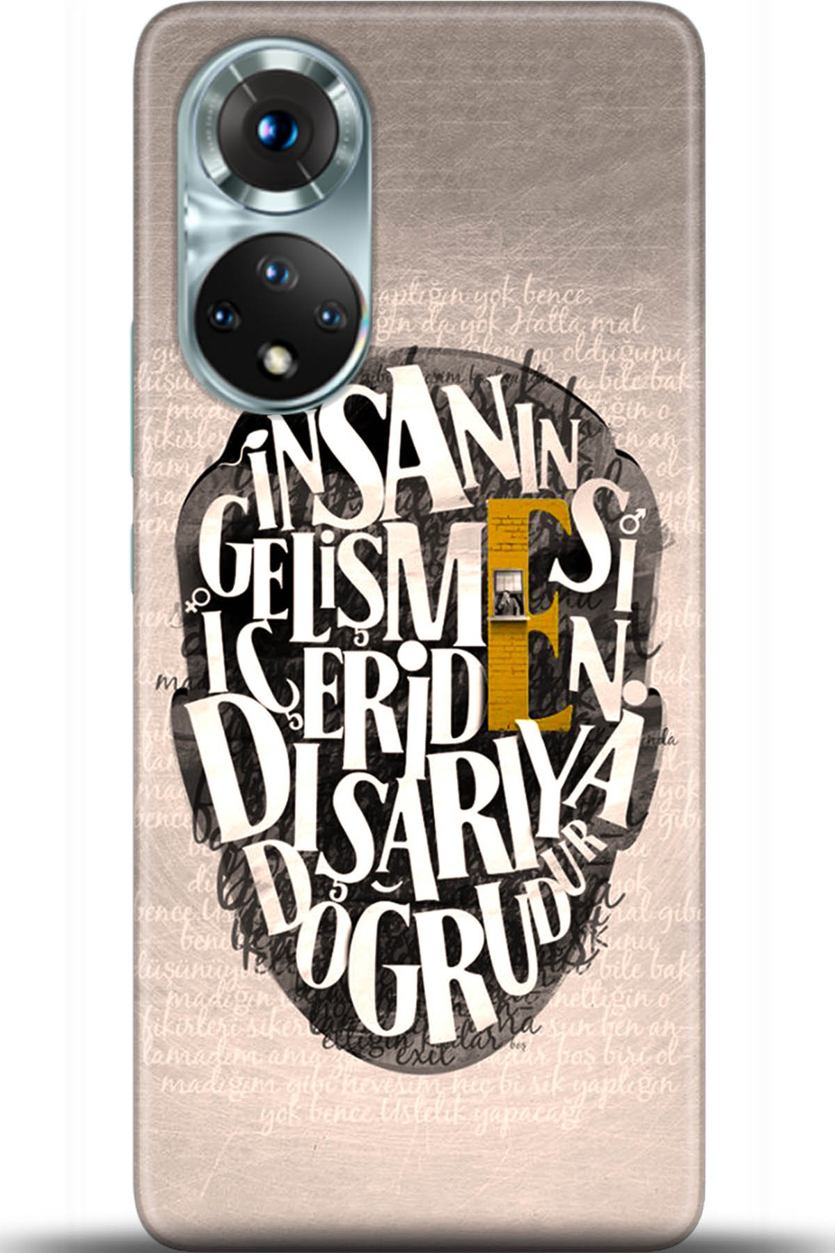 Honor 50 Kılıf HD Baskılı Kılıf - Followed Institution 5587