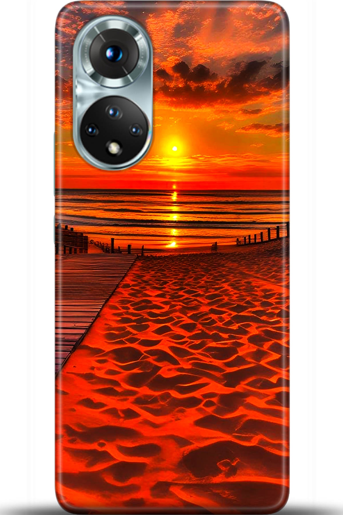 Honor 50 Kılıf HD Baskılı Kılıf - Followed Institution 5600