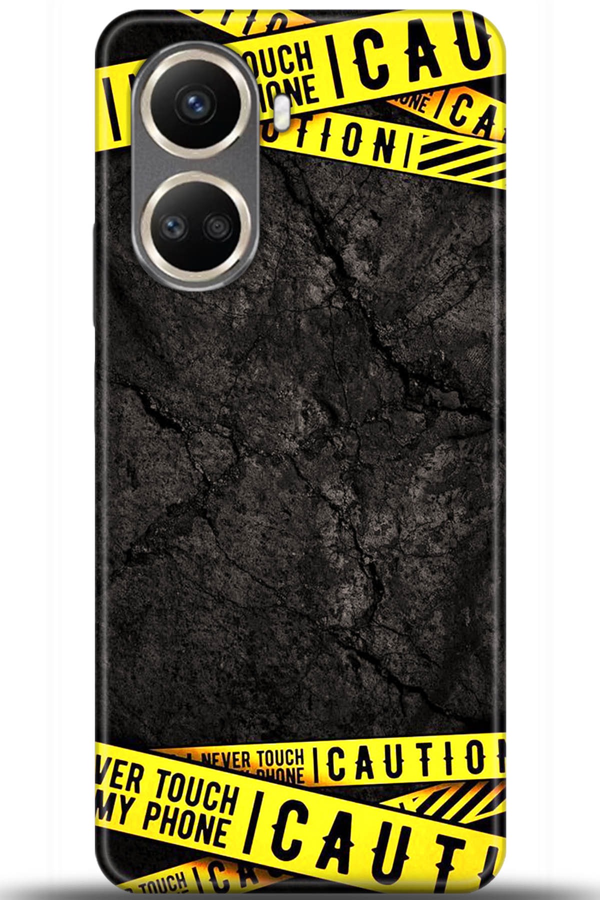 Huawei Nova 10 Uyumlu Kılıf HD Baskılı Kılıf - Followed Institution 5514