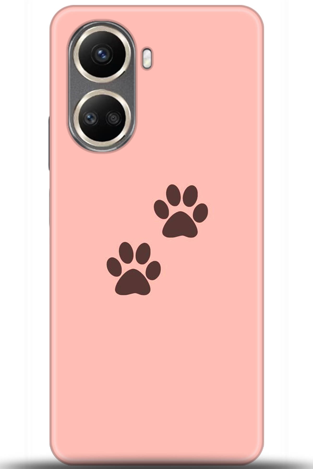 Huawei Nova 10 Uyumlu Kılıf HD Baskılı Kılıf - Followed Institution 5615