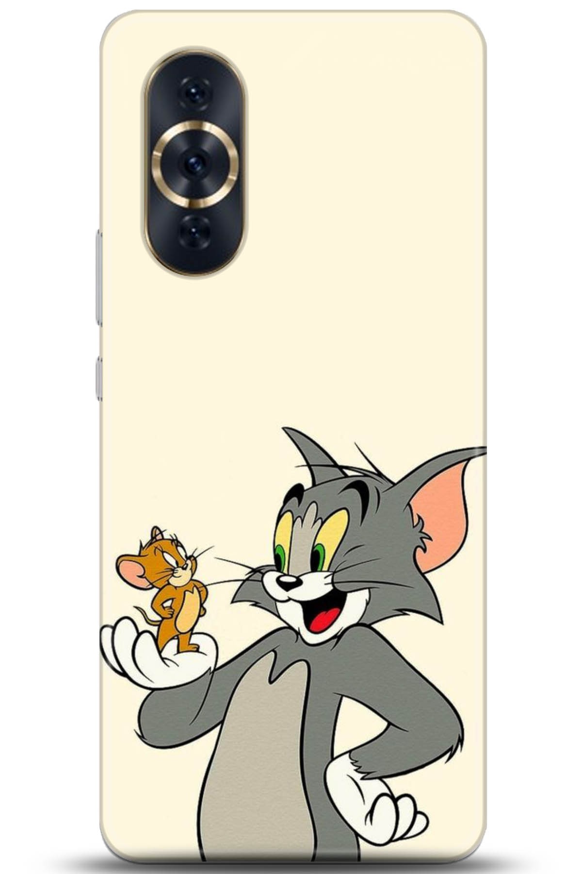 Huawei Nova 10 Pro Uyumlu Kılıf HD Baskılı Kılıf - Followed Institution 5030