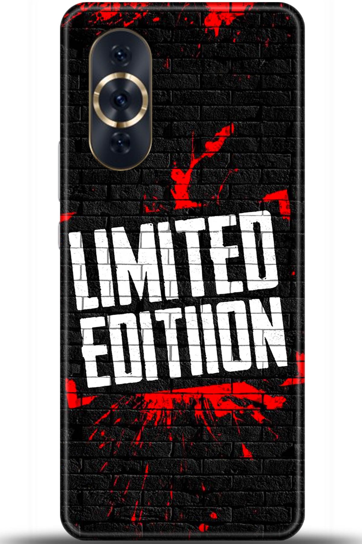 Huawei Nova 10 Pro Uyumlu Kılıf HD Baskılı Kılıf - Followed Institution 5454