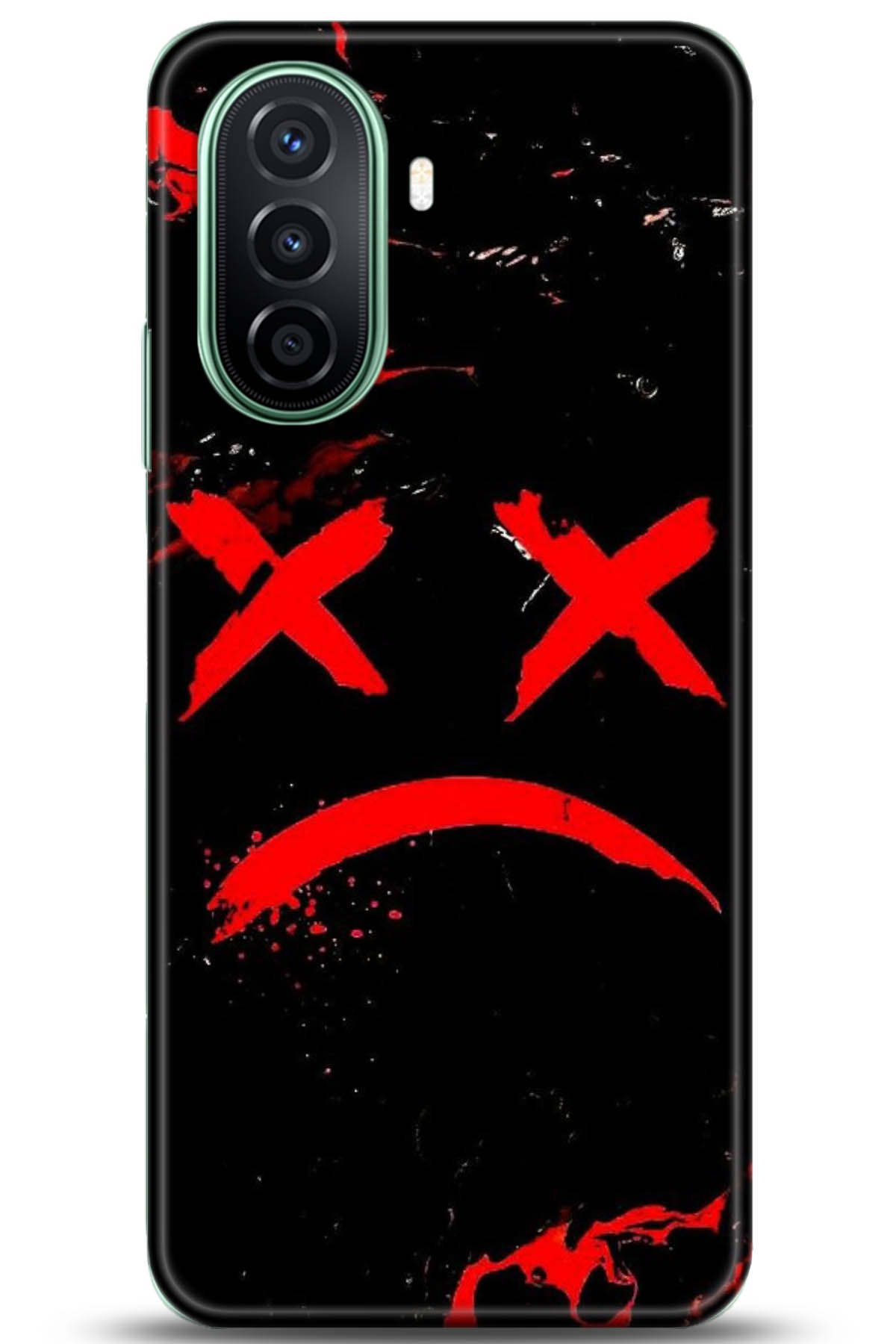 Huawei Nova Y70 Uyumlu Kılıf HD Baskılı Kılıf - Followed Institution 5139